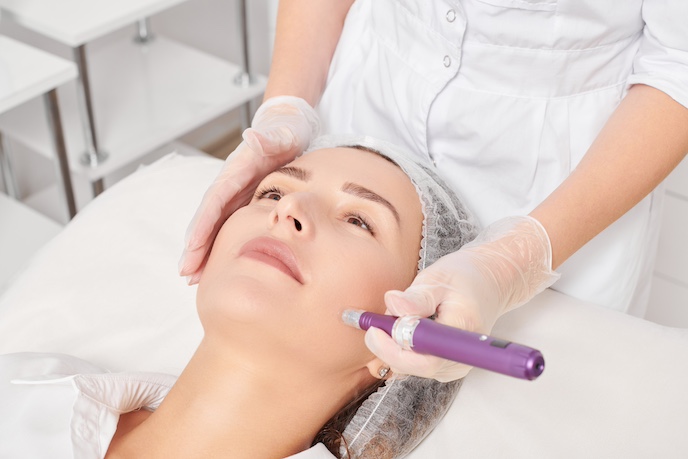 Microneedling: Für wen ist es geeignet? - Zielgruppen und Hauttypen Medizinisches oder kosmetisches Microneedling bei einer Frau
