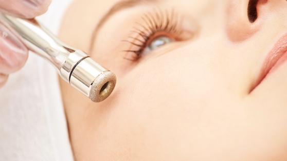 Was ist eigentlich Microdermabrasion? Microdermabrasion: Frauengesicht mit Microdermabrasions-Gerät