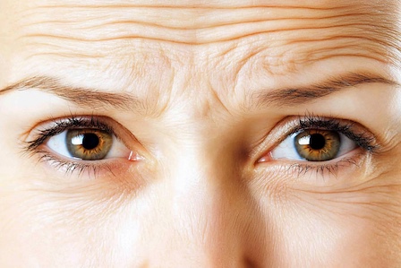 Mimikfalten – Welches Microneedling-Serum ist das Richtige? Mimikfalten mit Microneedling-Serum behandeln