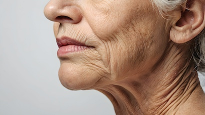 Frau mit schlaffer Haut im Gesicht