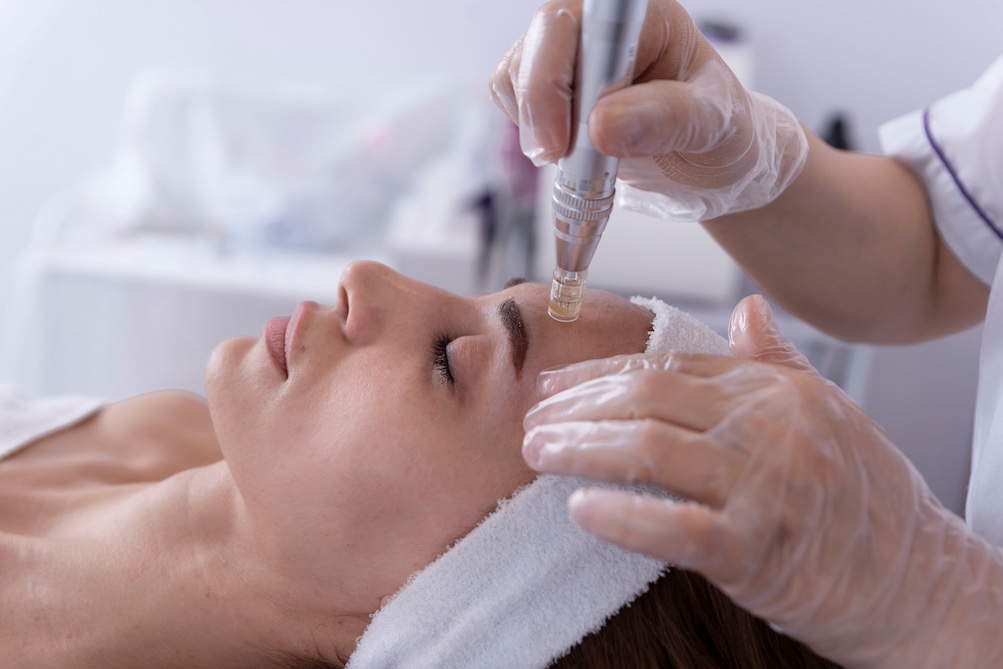 Microneedling wie oft? | Tipps und Anregungen für Dermaroller und Dermapen Microneedling wie oft?
