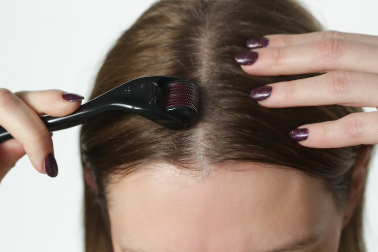 Mit Dermaroller Haare wieder waschsen lassen - Microneedling bei Haarausfall