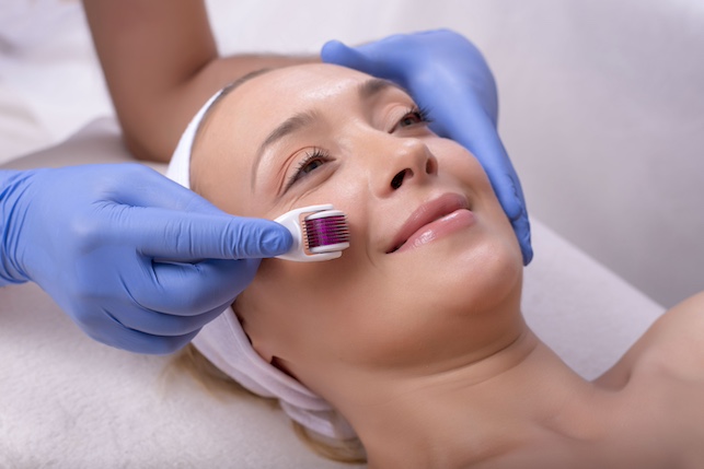 Microneedling für verschiedene Hauttypen: Tipps und Empfehlungen Microneedling Behandlung im Gesicht einer Frau mit einem Dermaroller