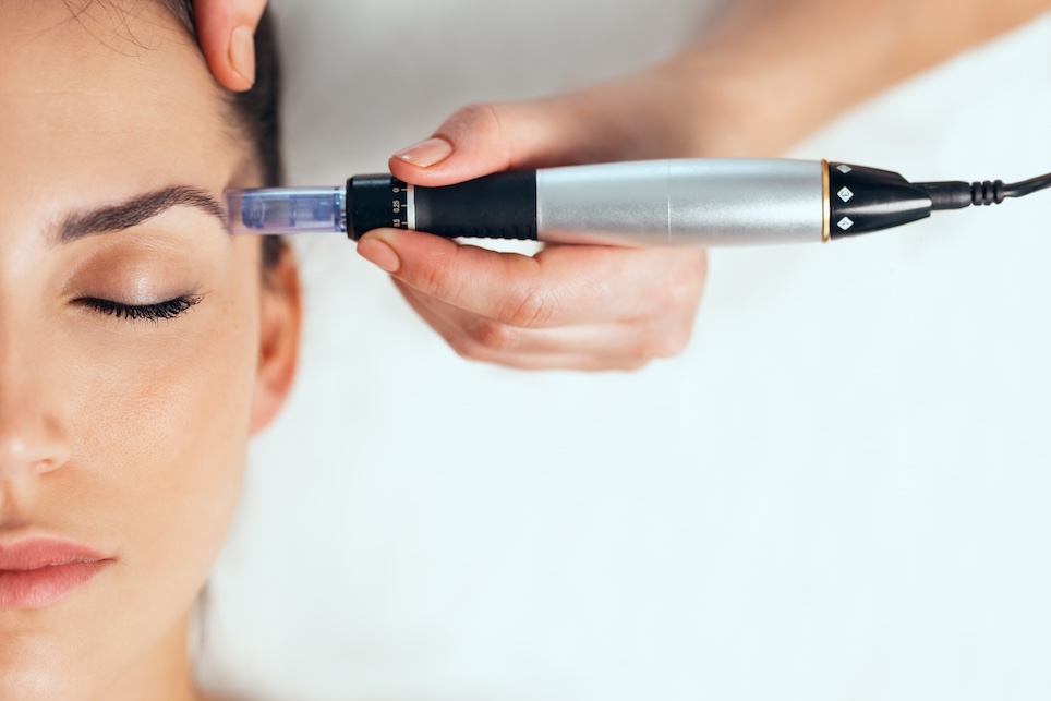 Microneedling Behandlung mit Dermaroller oder Dermapen | Anleitung von A – Z Microneedling-Behandlung mit einem Dermapen